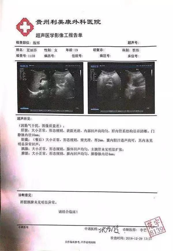 隆鼻手术发生意外 贵州19岁大二女生不幸香消玉殒